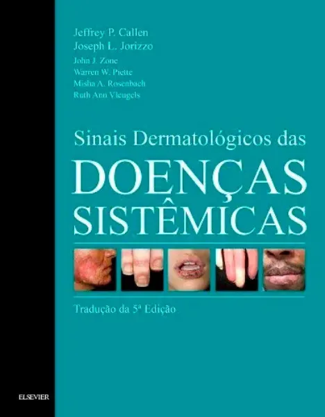 Imagem de Sinais Dermatológicos nas Doenças Sistémicas