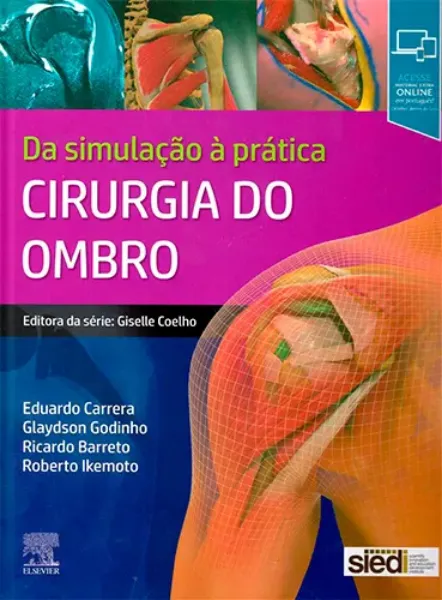 Imagem de Cirurgia do Ombro