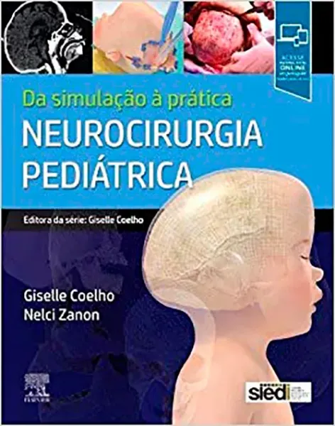 Imagem de Neurocirugia Pediátrica