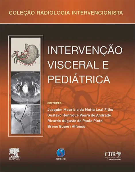 Imagem de Intervenção Vascular Visceral Pediátrica