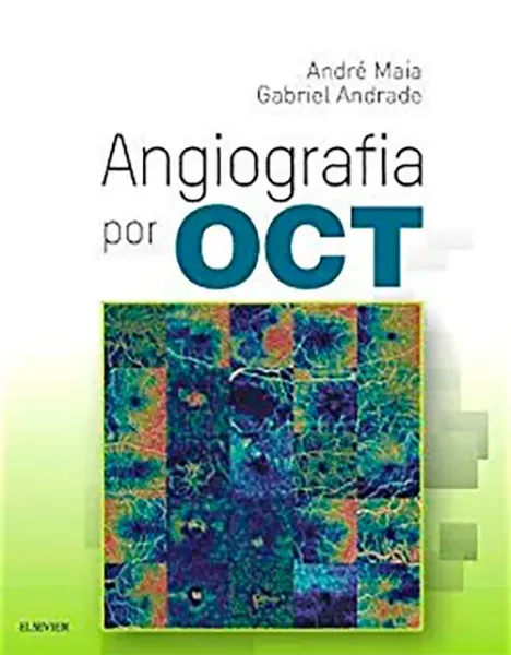 Imagem de Angigrafia por OCT