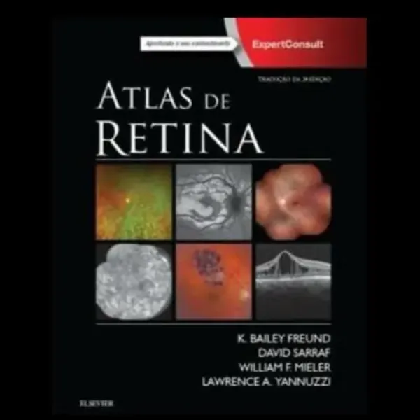 Imagem de Atlas de Retina