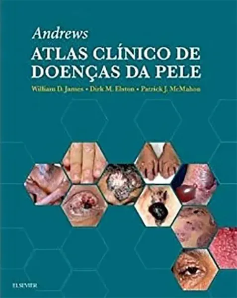 Imagem de Andrew Atlas Clínico de Doenças da Pele