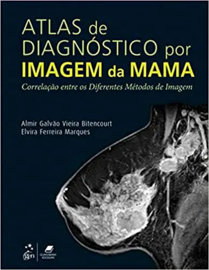 Imagem de Atlas de Diagnóstico por Imagem da Mama