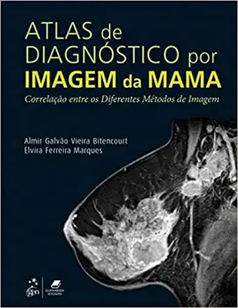 Imagem de Atlas de Diagnóstico por Imagem da Mama