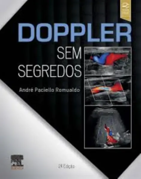 Imagem de Doppler Sem Segredos