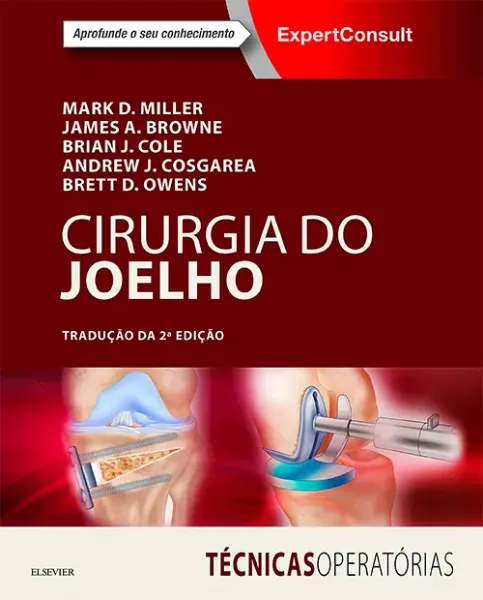 Imagem de Cirurgia do Joelho