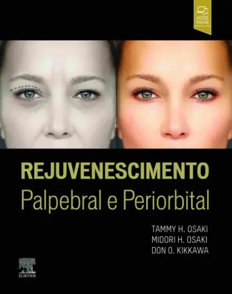 Imagem de Rejuvenescimento Palpebral e Periorbital