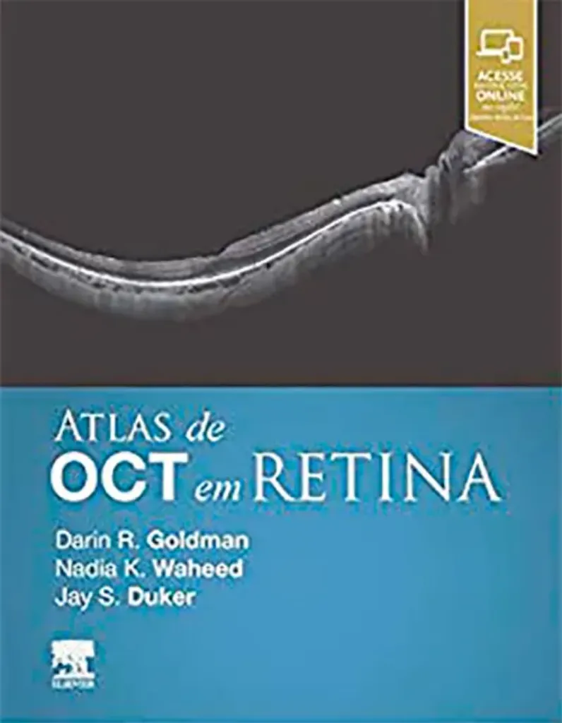 Imagem de Atlas de OCT em Retina
