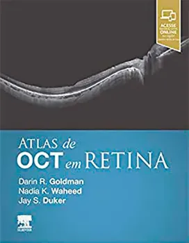 Picture of Book Atlas de OCT em Retina