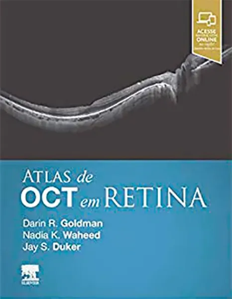 Imagem de Atlas de OCT em Retina