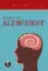 Imagem de Doença de Alzheimer