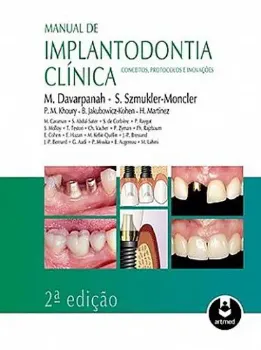Picture of Book Manual de Implantodontia Clínica