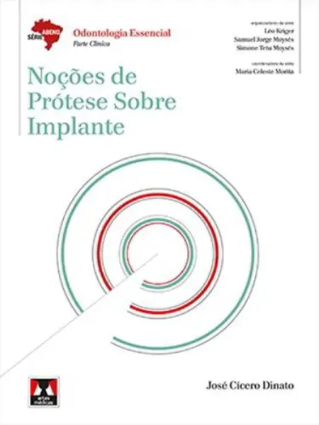 Imagem de Noções de Prótese Sobre Implante