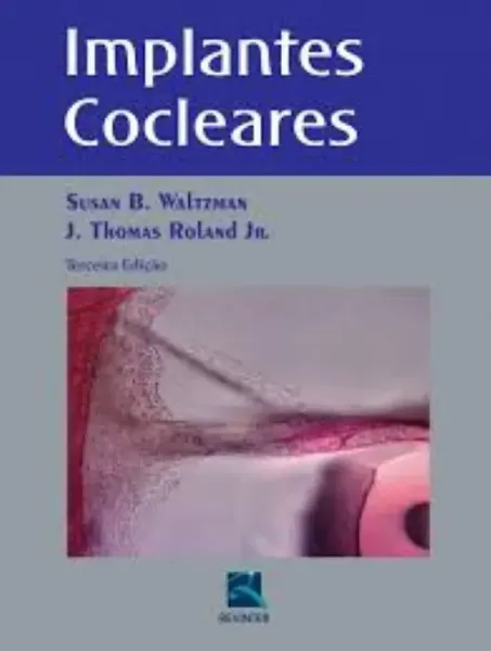 Imagem de Implantes Cocleares