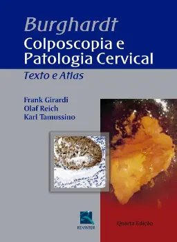 Picture of Book Burghardt - Colposcopia e Patologia Cervical