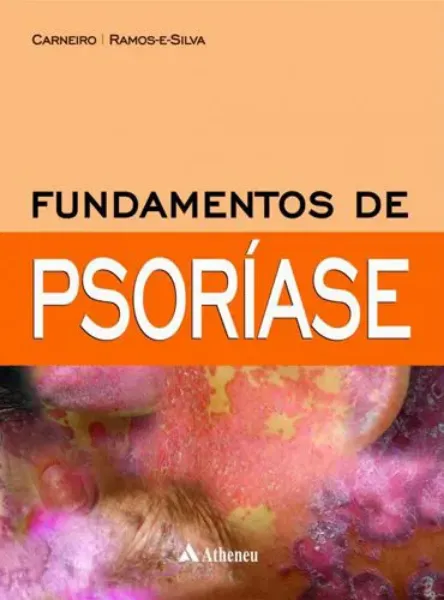 Imagem de Fundamentos de Psoríase