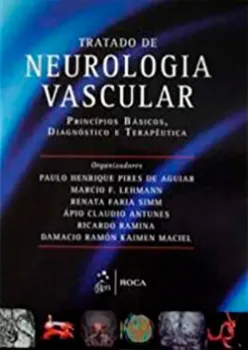 Imagem de Tratado de Neurologia Vascular