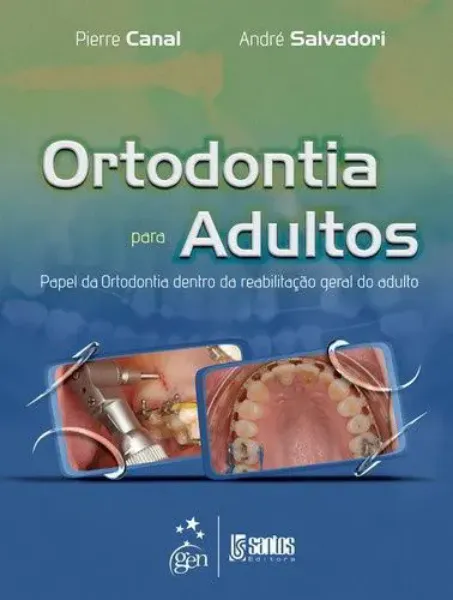 Imagem de Ortodontia para Adultos