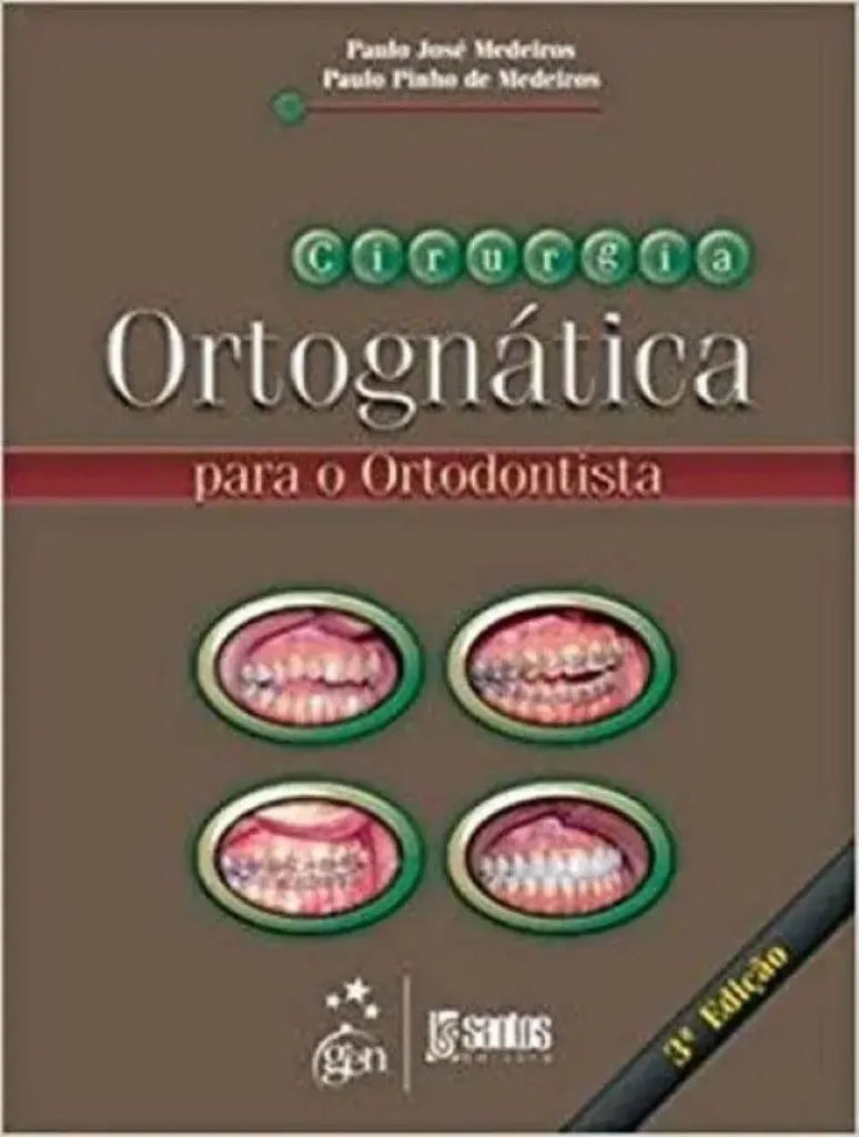Imagem de Cirurgia Ortognática para o Ortodentista