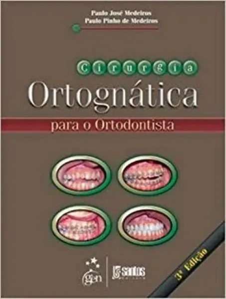 Imagem de Cirurgia Ortognática para o Ortodentista