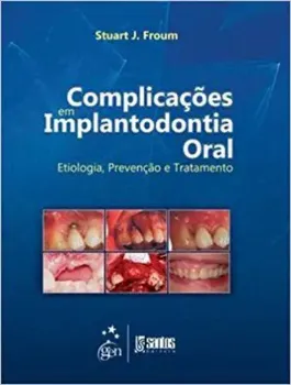 Picture of Book Complicações em Implantodontia Oral: Etiologia, Prevenção e Tratamento