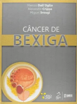 Picture of Book Cancer de Bexiga