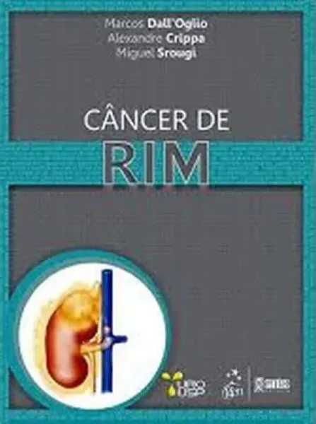 Imagem de Cancer de Rim