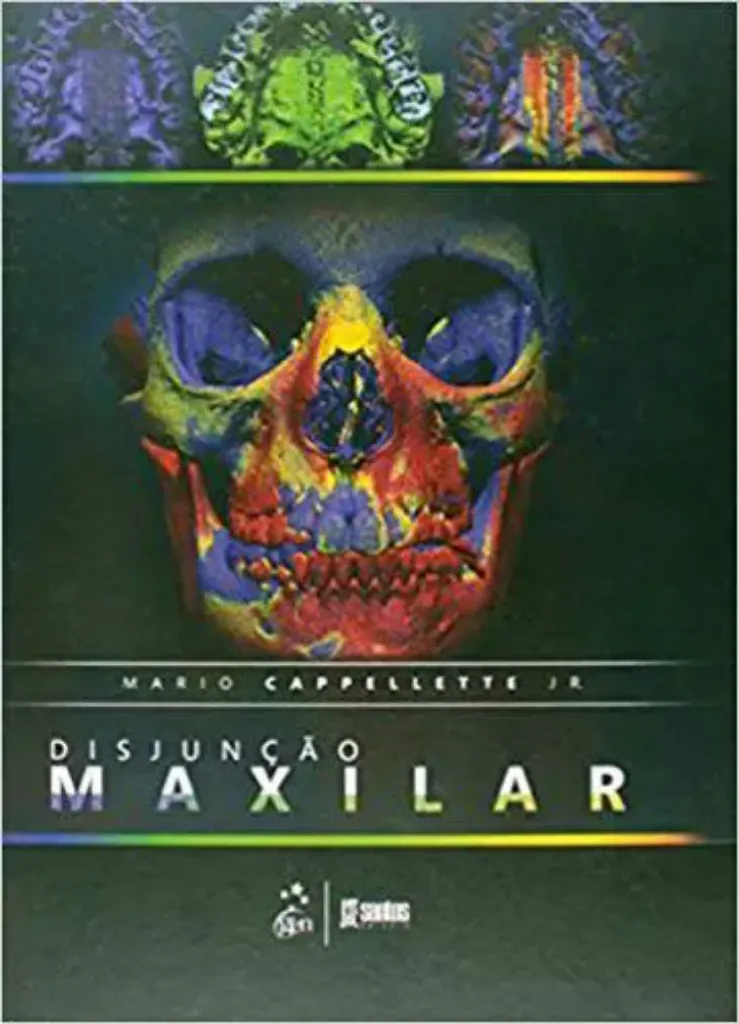 Imagem de Disjunção Maxilar