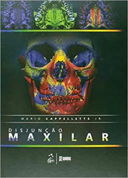 Imagem de Disjunção Maxilar