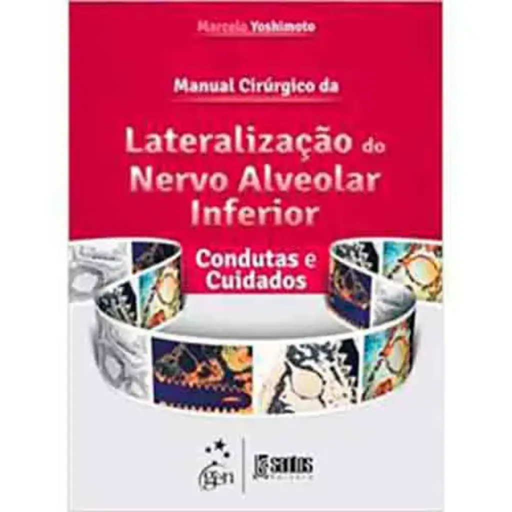 Imagem de Manual Cirúrgico Lateral Nervo Alveolar Inferior