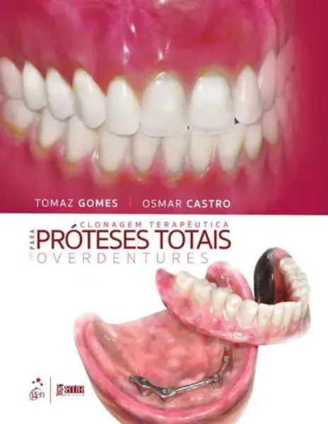 Imagem de Clonagem Terapêutica para Próteses Totais e Overdentures