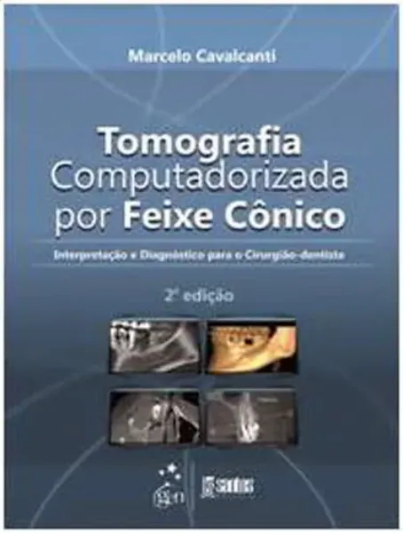 Imagem de Tomografia Computadorizada por Feixe Cônico Interpretação e Diagnóstico para o Cirurgiãodentista