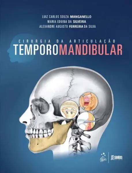 Imagem de Cirurgia Articulação Temporomandibular