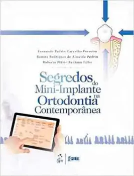 Picture of Book Segredos Mini-Implante Ortodontia Contemporânea