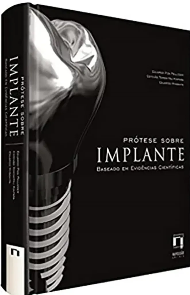 Imagem de Prótese Sobre Implante - Baseado em Evidências Científicas