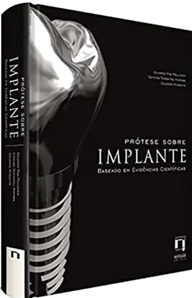 Imagem de Prótese Sobre Implante - Baseado em Evidências Científicas