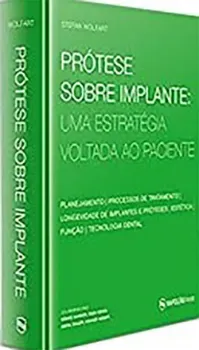 Picture of Book Prótese Sobre Implante - Uma Estratégia Voltada ao Paciente
