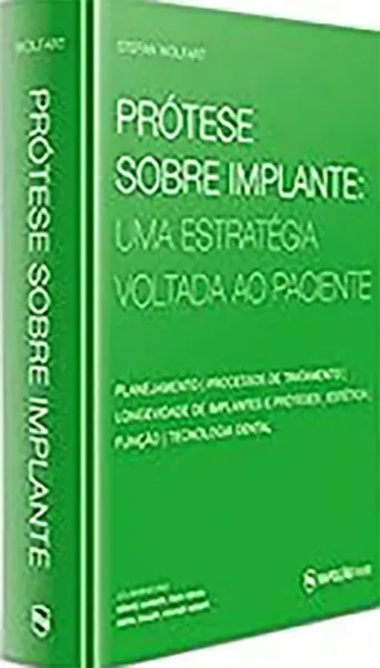 Imagem de Prótese Sobre Implante - Uma Estratégia Voltada ao Paciente