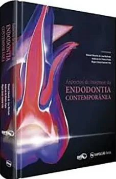 Imagem de Aspectos de Interesse da Endodontia Contemporânea