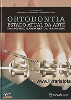 Imagem de Ortodontia - Estado Atual da Arte, Diagnóstico, Planejamento e Tratamento
