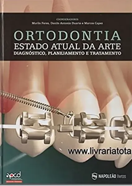 Imagem de Ortodontia - Estado Atual da Arte, Diagnóstico, Planejamento e Tratamento