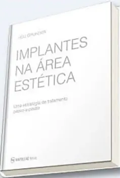 Picture of Book Implantes na Área Estética - Uma Estratégia de Tratamento Passo-a-Passo