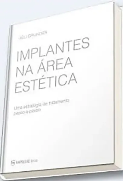 Imagem de Implantes na Área Estética - Uma Estratégia de Tratamento Passo-a-Passo