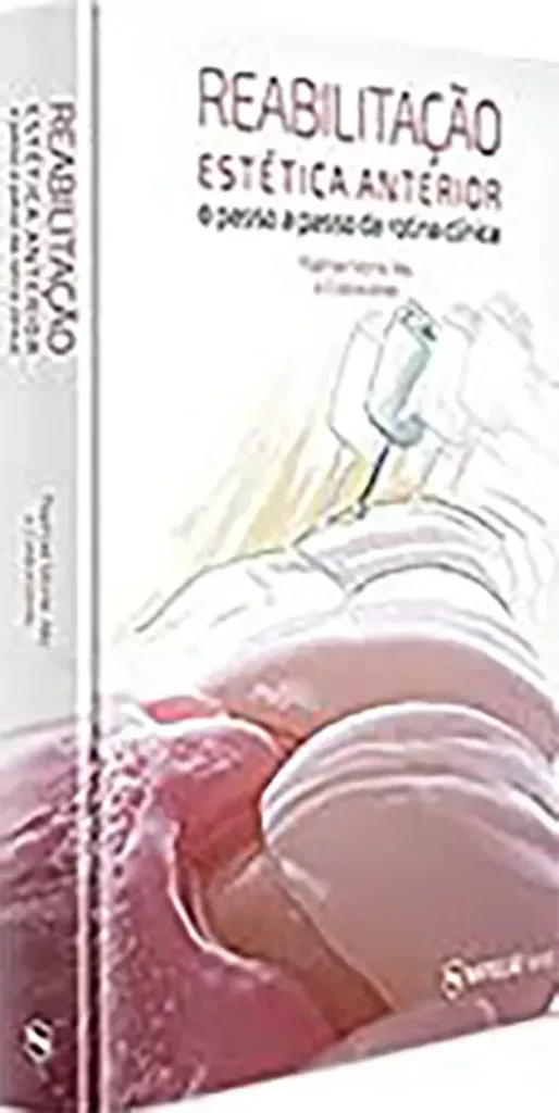Imagem de Reabilitação Estética Anterior - O Passo a Passo da Rotina Clínica