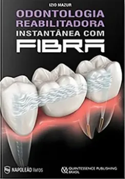 Imagem de Odontologia Reabilitadora Instantânea com Fibra