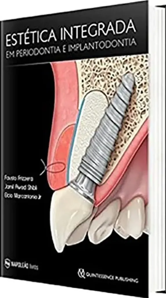 Imagem de Estética Integrada em Periodontia e Implantodontia