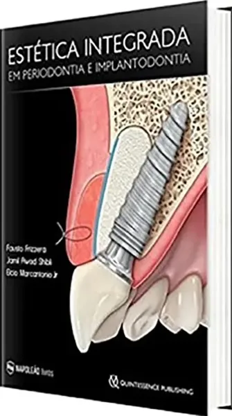 Imagem de Estética Integrada em Periodontia e Implantodontia