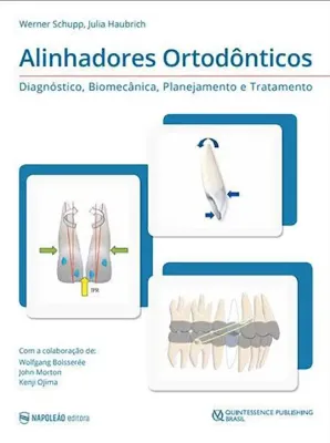 Imagem de Alinhadores Ortodônticos - Diagnóstico, Biomecânica, Planejamento e Tratamento