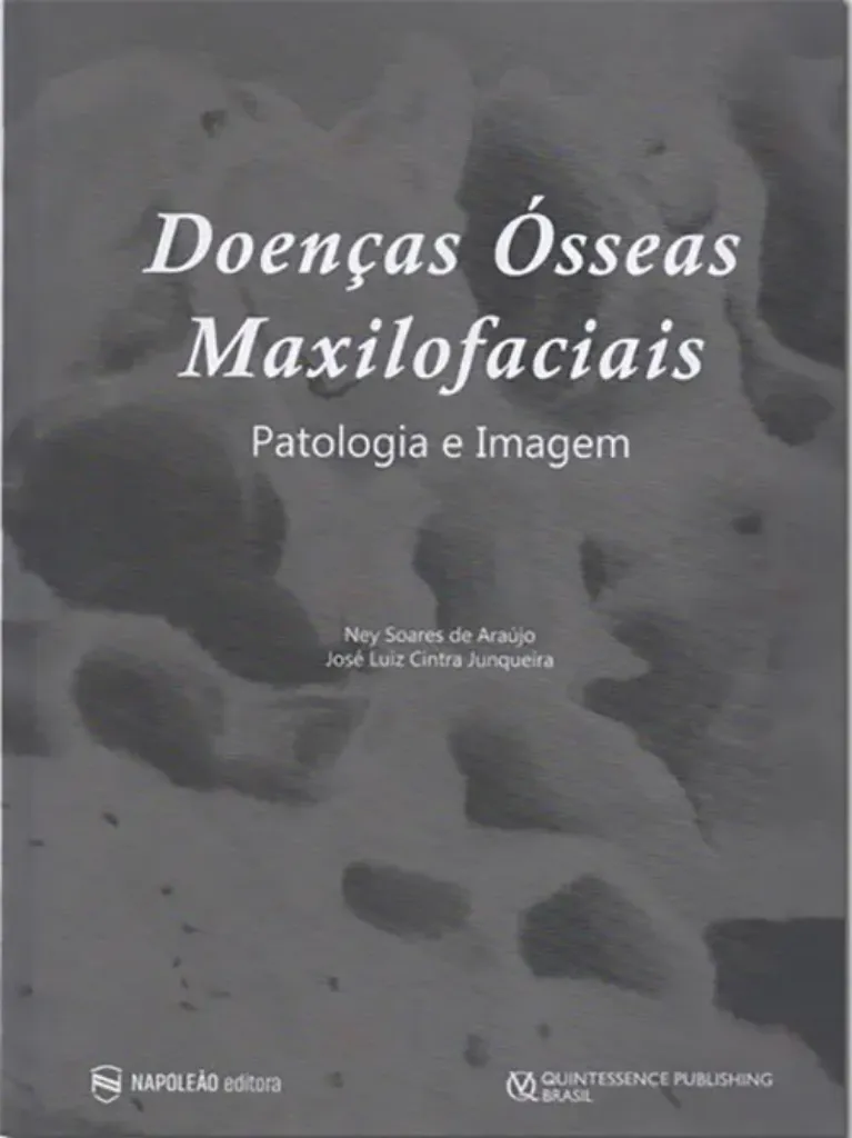Imagem de Doenças Ósseas Maxilofaciais